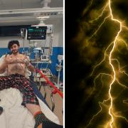 STRUCK: Aidan Rowan, from Abingdon, in hospital after being struck by lightning while playing video games in his living room. Picture credit: Aidan Rowan